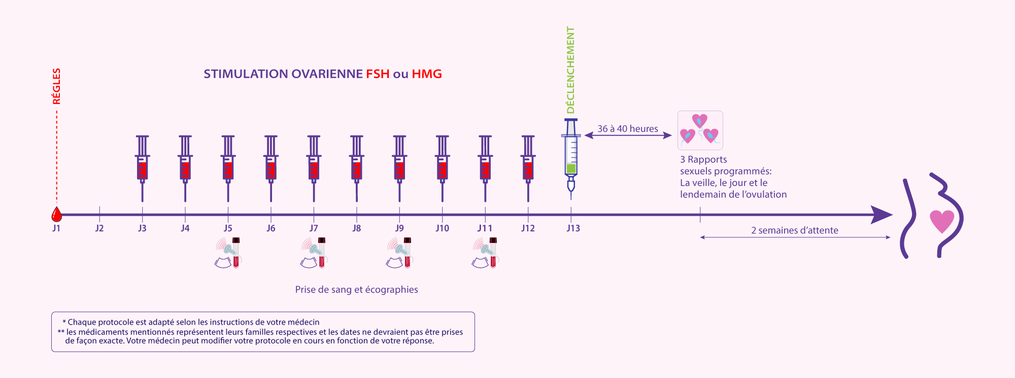 Schéma des étapes de la stimulation ovarienne simple par injections hormonales au centre IRIFIV Casablanca pour favoriser l’ovulation et la fertilité féminine
