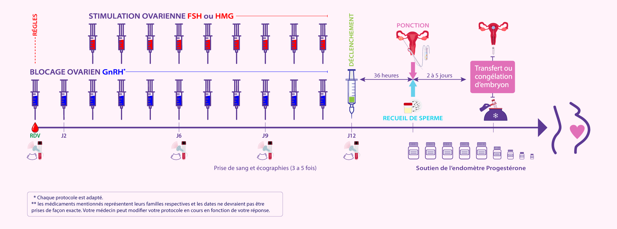 Illustration du protocole agoniste court de stimulation ovarienne utilisé pour les patientes à faible réserve ovarienne