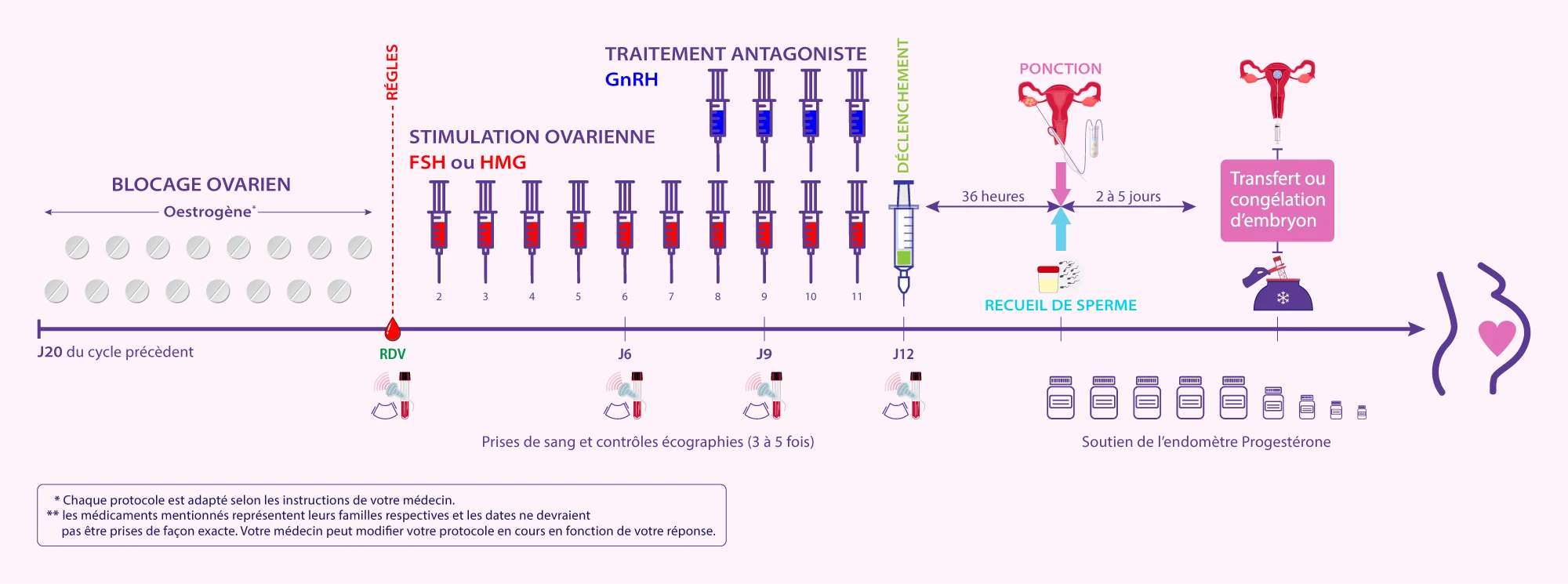 Schéma du protocole antagoniste en FIV développé par IRIFIV Casablanca