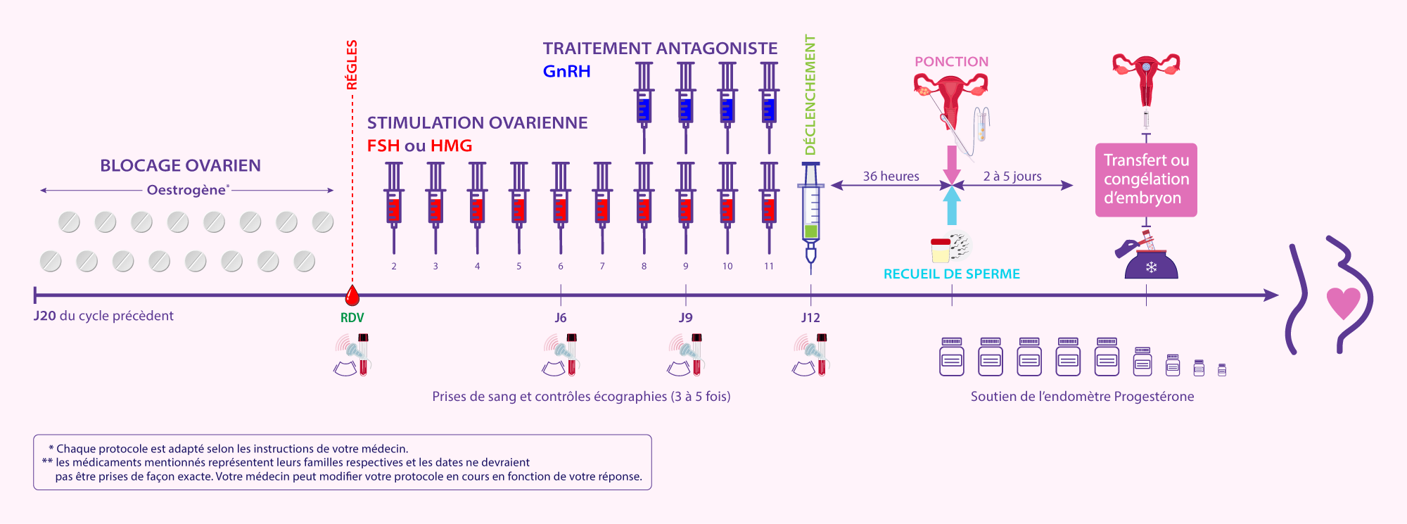 Illustration du protocole antagoniste utilisé pour la stimulation ovarienne dans le cadre d’une FIV au centre IRIFIV Casablanca