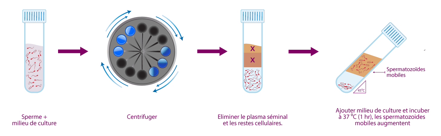 Technique swim-up pour isoler les spermatozoïdes mobiles dans le laboratoire d’IRIFIV Casablanca