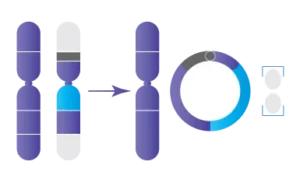 Anomalie chromosomique : Chromosome en anneau