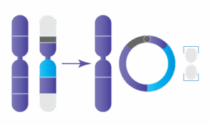 Anomalie chromosomique : Chromosome en anneau