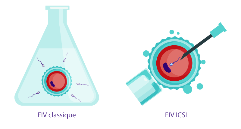 Différence entre la FIV et l'ICSI illustrée par IRIFIV Casablanca