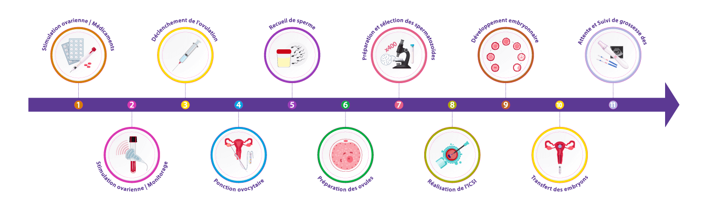 Étapes de la FIV-ICSI au centre IRIFIV Casablanca – procédure de micro-injection