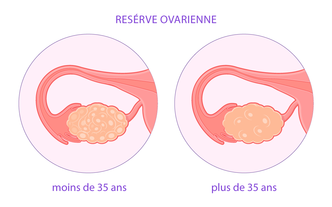 Schéma expliquant la réserve ovarienne et son impact sur la fertilité féminine