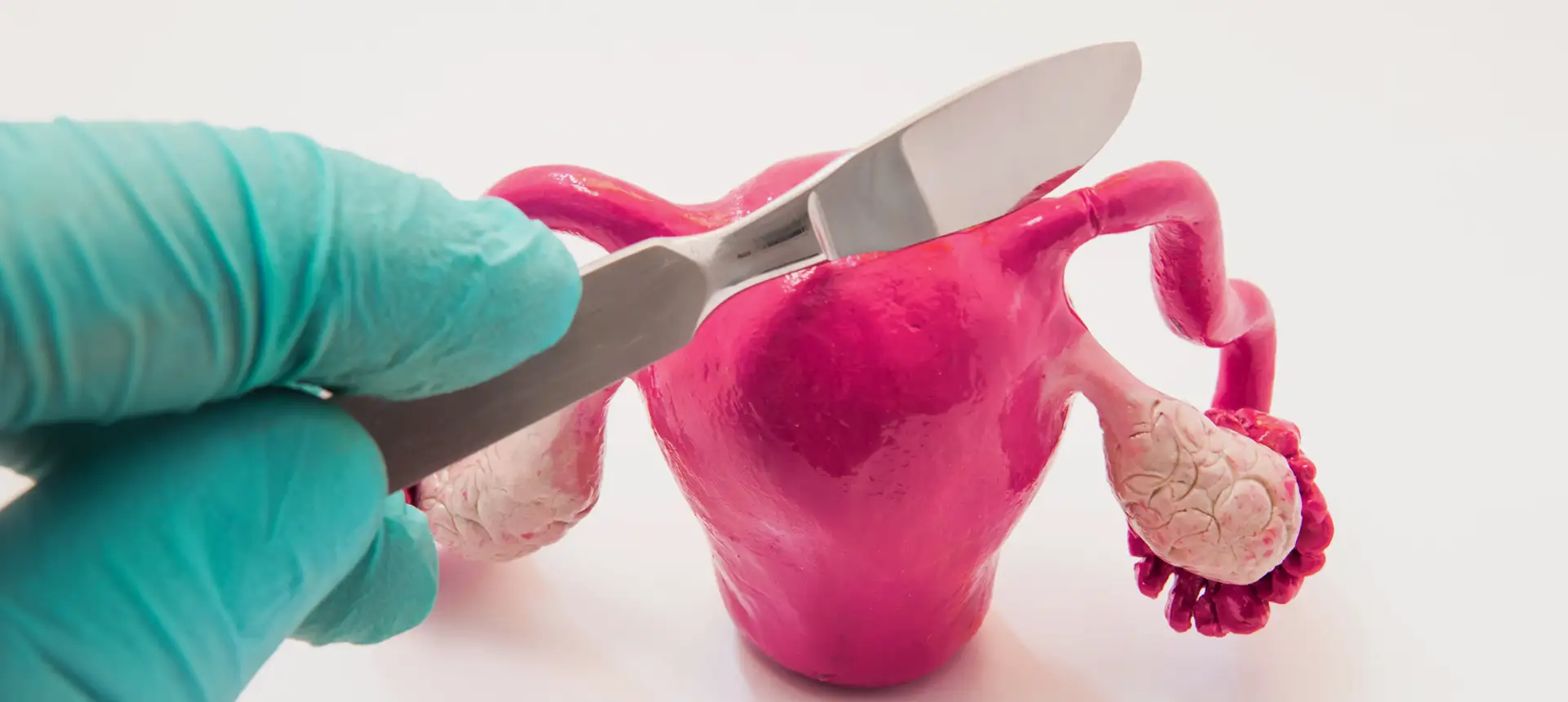 Salpingectomie Pré-FIV – IRIFIV Casablanca Salpingectomie pré-FIV au centre IRIFIV Casablanca – chirurgie de la fertilité