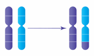 Anomalie chromosomique : Translocation réciproque déséquilibrée