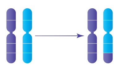 Anomalie chromosomique : Translocation réciproque déséquilibrée