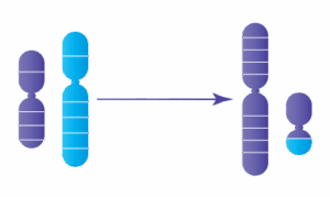 Anomalie chromosomique : Translocation Robertsonienne