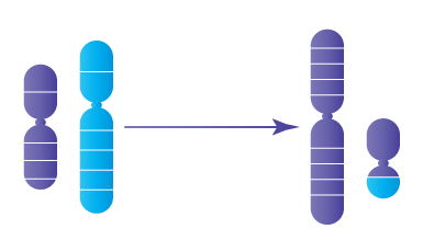 Anomalie chromosomique : Translocation Robertsonienne